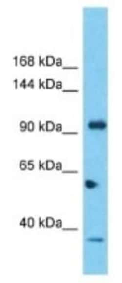 SIPA1L2 Rabbit anti-Human, Polyclonal, Novus Biologicals:Antibodies:Primary